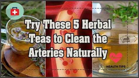 Try These 5 Herbal Teas To Clean The Arteries Naturally Health Today