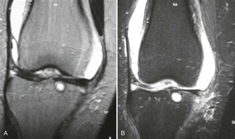 Specialized Imaging Radiology Key