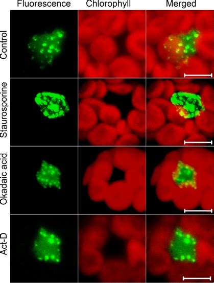 Confocal Images Of Arabidopsis Protoplasts Expressing Gfp U K That