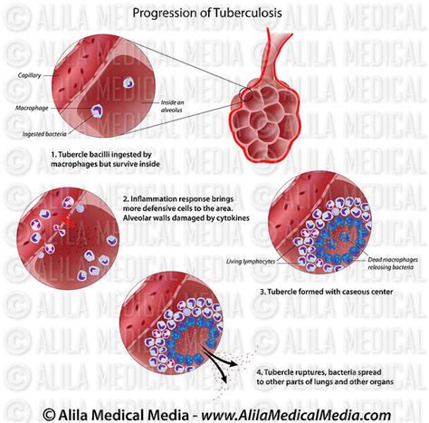 Alila Medical Media Alveoli Structure Labeled Diagram Medical