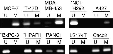 Methylation Specific PCR MSP Analysis Of The MUC4 Gene Promoter