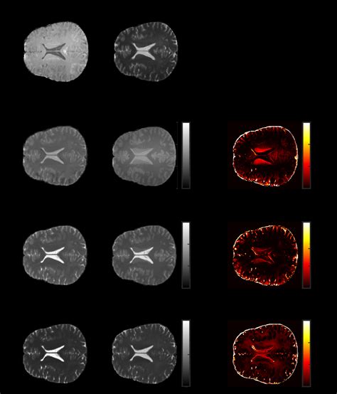 A Representative Axial Slice Of T1 T2 And PD Maps Synthesized From The