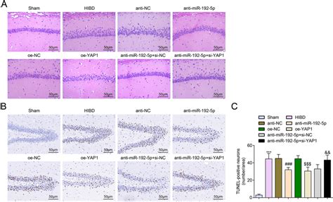 Down Regulated MiR 192 5p Or Up Regulated YAP1 Decelerates The