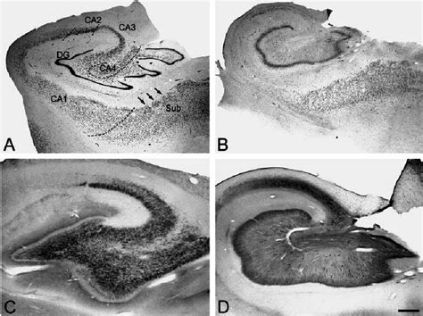 A B Low Power Photomicrographs From Nissl Stained Sections