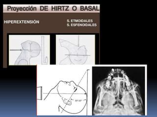 Semiolog A De La Nariz Ppt