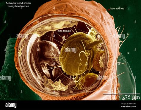 Tracheal Mite Hi Res Stock Photography And Images Alamy