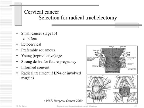 Laparoscopic Surgery In Gynaecologic Oncology An Added Value Ppt Download