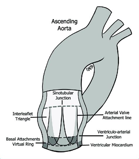 Schematic Representation Of The Aortic Root Highlighting The
