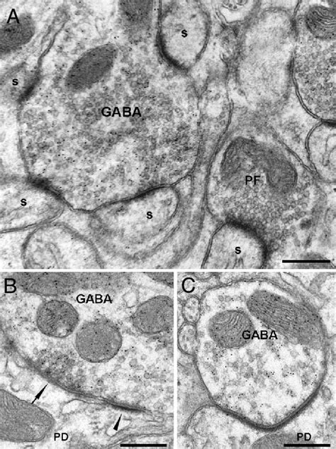 Ultrastructural Features Of Gabaergic Terminals Labeled With The