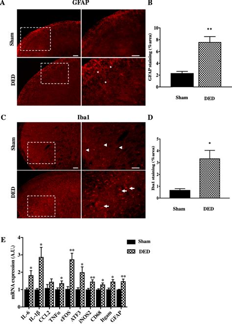 GFAP And Iba1 Immunoreactivity And Expression Of Neuronal And