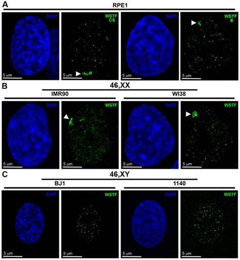 A Representative Htert Rpe Xx Nuclei Showing Wstf Enrichment By