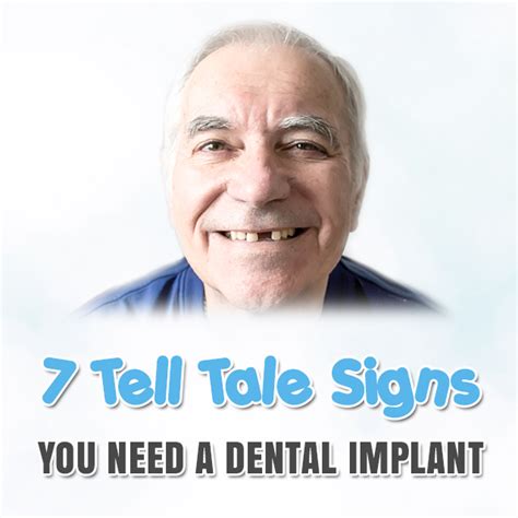 7 Tell Tale Signs You Need A Dental Implant Adhp