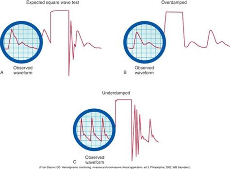 Hemodynamic Monitoring Flashcards Quizlet