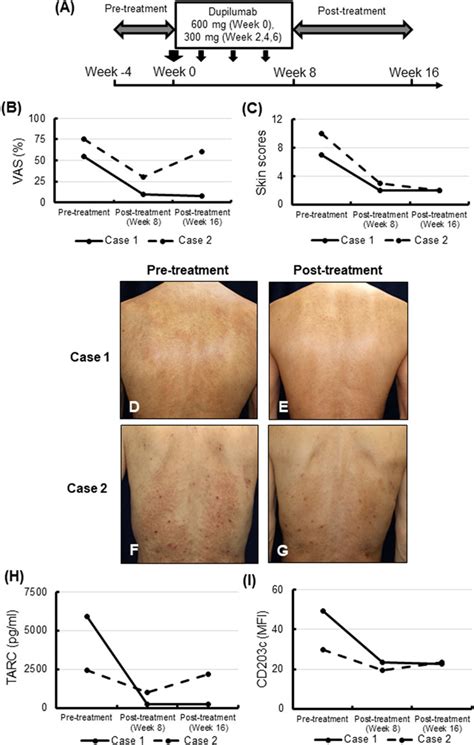 Frontiers Publishing Partnerships Dupilumab For Prurigo Chronica