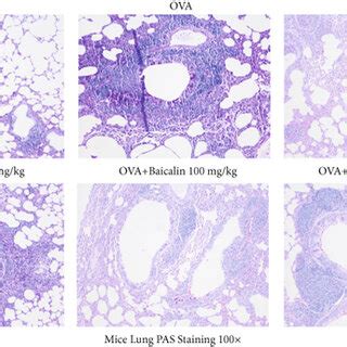 Effects Of Baicalin On Ahr Inflammatory Cell Infiltration Lung