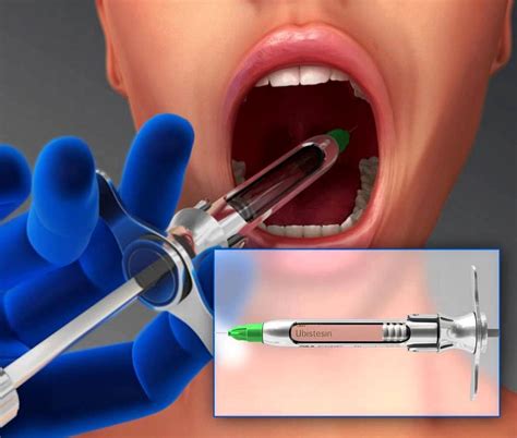 ANESTESIA DENTAL Anestésicos locales en Odontología Propiedades