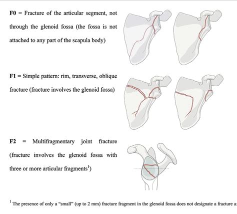 Figure 5 From The AO Foundation And Orthopaedic Trauma Association AO