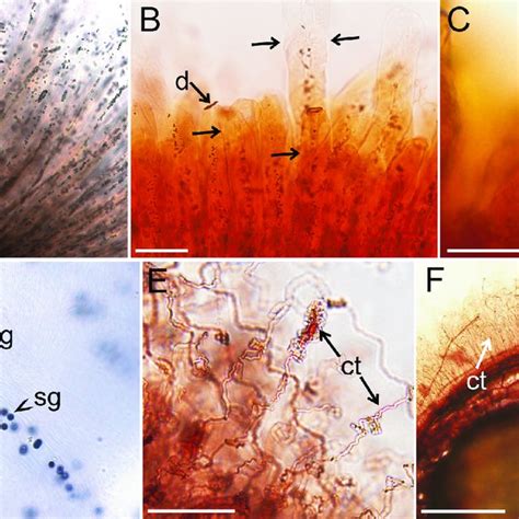 The Morphology Of The Air Dried Seed Coat Mucilage A B Arabidopsis