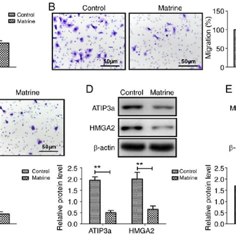 Matrine Suppresses Ovarian Cancer Cell Viability Migration And