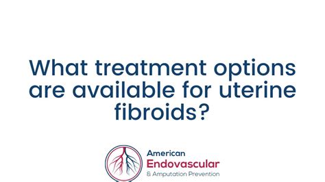 What Treatment Options Are Available For Uterine Fibroids Youtube