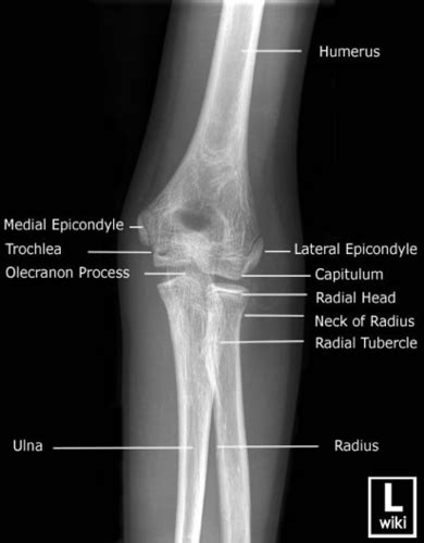 2 The Upper Extremity Principles Of Diagnostic Imaging Slides 16