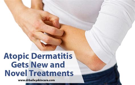 Atopic Dermatitis Gets New And Novel Treatments Dr Bailey Skin Care