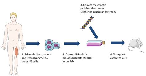 Duchenne Muscular Dystrophy Diagram