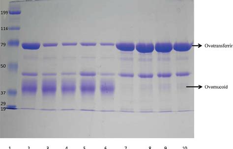 The Sds Page Picture Of The Lower Levels Of Ammonium Sulfate As And Download Scientific