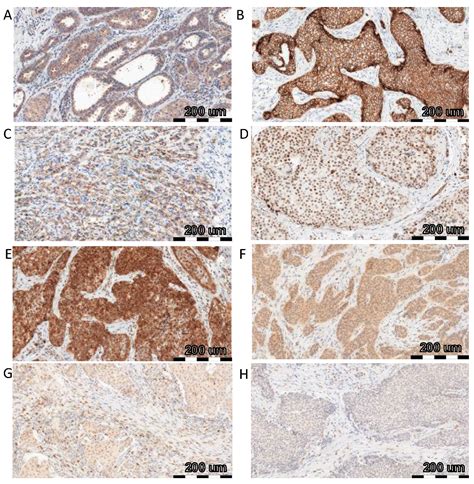 IJMS Free Full Text The Role Of Irisin FNDC5 Expression And Its