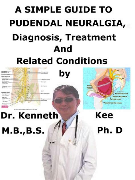 A Simple Guide To Pudendal Neuralgia Diagnosis Treatment And Related