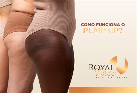 Como Funciona O Pump Up Procedimento Est Tico Para O Bumbum Royal Face