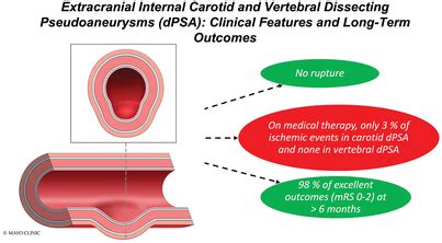 Extracranial Internal Carotid And Vertebral Dissecting Pseudoaneurysms