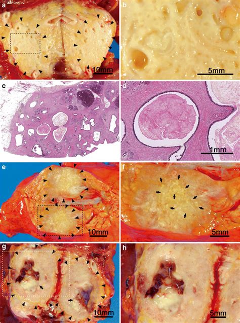 Macroscopic And Histological Features Of Pancreatic Ductal Download Scientific Diagram