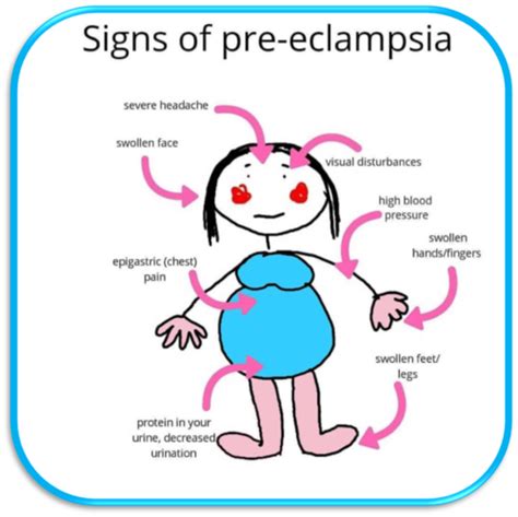 Pregnancy Complications Pt 2 Flashcards Quizlet