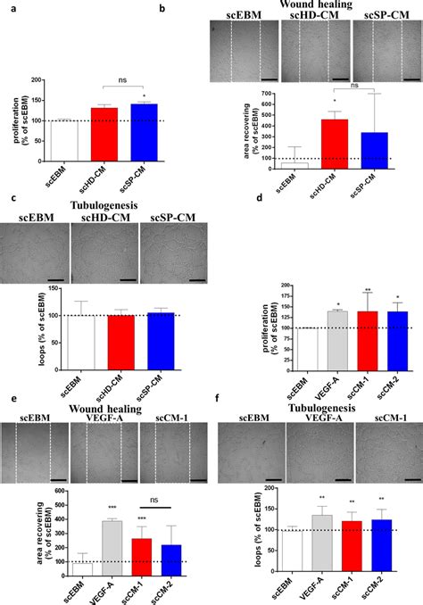 EPC Secretome From Stroke Patients Promotes In Vitro Angiogenesis