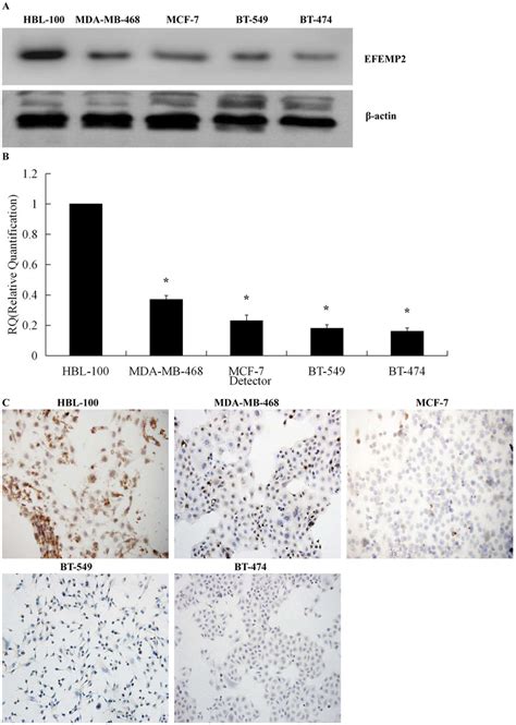 Expression Of Efemp In Breast Epithelial Cells And Breast Cancer