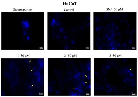 Nuclear Staining Using Dapi In Hacat Cells After Treatment With Gnp 50