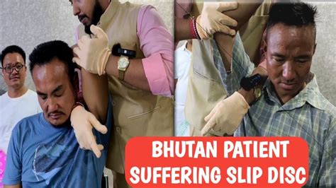 Bhutan Patient Suffering Lower Back Pain Treatment By Chiropractic