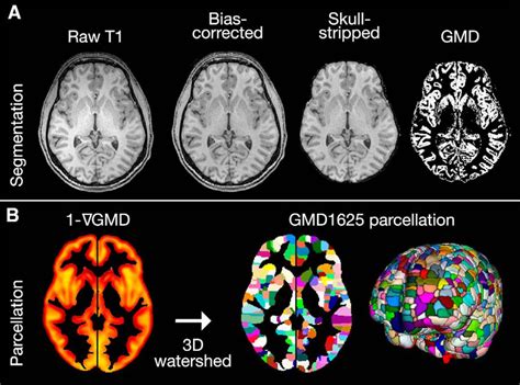 Age Related Effects And Sex Differences In Gray Matter Density Volume