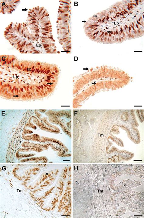 Cellular Expression And Localization Of Estrogen Receptor And