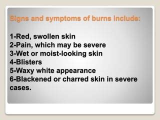 The burns | PPT