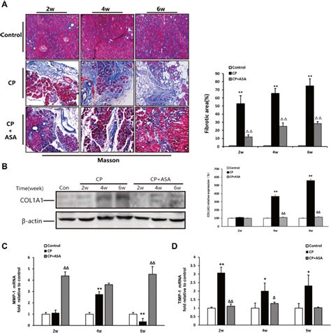 Aspirin Inhibits Pancreatic Fibrosis In Pancreas Of Mice Treated With Download Scientific