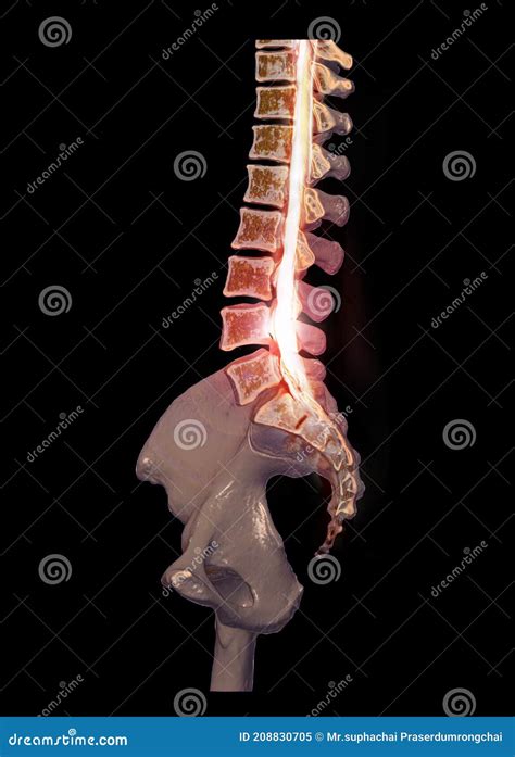 Ct Lumbar Spine Or L S Spine D Rendering Image Sagittal View D