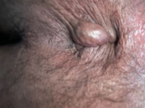 Tight Hairy Asshole Nude Pics Xhamster