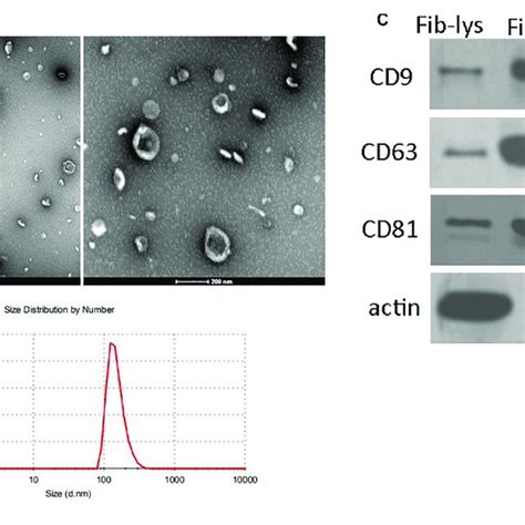 Characteristics Of Human Bone Marrow Derived Mesenchymal Stem Cell