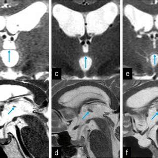 Axial A Coronal B And Midsagittal C T Weighted Magnetic Resonance