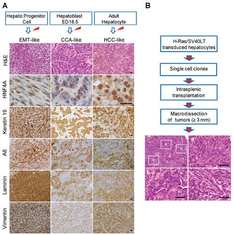 A Representative Hande Images And Immunostaining Of Hcc Cca And Download Scientific Diagram