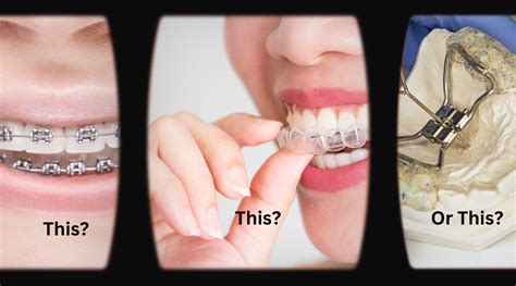 Choosing The Right Orthodontic Treatment Tips And Insights