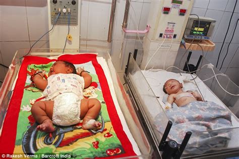 India's biggest baby ever born is a massive 13lb and has obesity risk ...