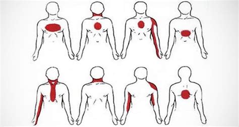 Ces 6 Symptômes Permettent De Reconnaître Une Crise Cardiaque Un Mois